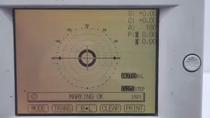 Topcon CL-100 Computerized Lensmeter