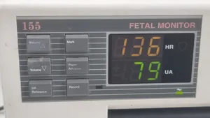 Corometrics Medical Systems Fetal Monitor 155 with Ultrasonic Transducer 5700