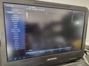ALPINION E-CUBE i7 PORTABLE ULTRASOUND SYSTEM -DIAGNOSTIC ULTRASOUND MACHINE